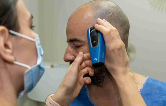 cedric greffe de cheveux budapest