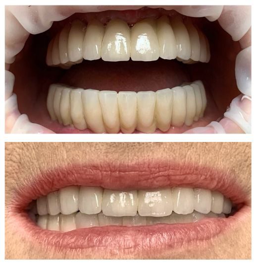 sourire après marie madeleine mercz dental