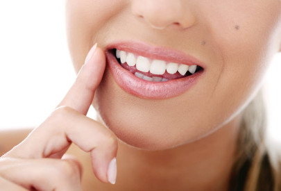 sourire de femme après un blanchiment dentaire