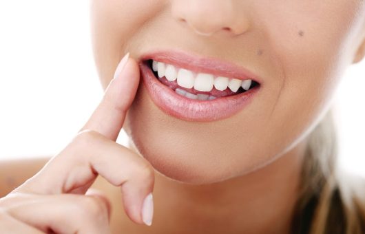 sourire de femme après un blanchiment dentaire