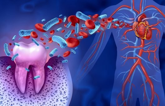 Illustration 3D montrant des bactéries circulant du site d'une dent vers le cœur à travers le système sanguin, mettant en évidence la connexion entre la santé dentaire et les maladies cardiovasculaires.