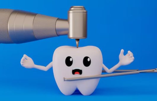 Une dent se fait soigner à l'aide d'un pivot ou implant dentaire.