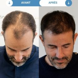 Cédric B.