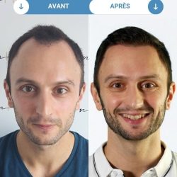 Guillaume D.