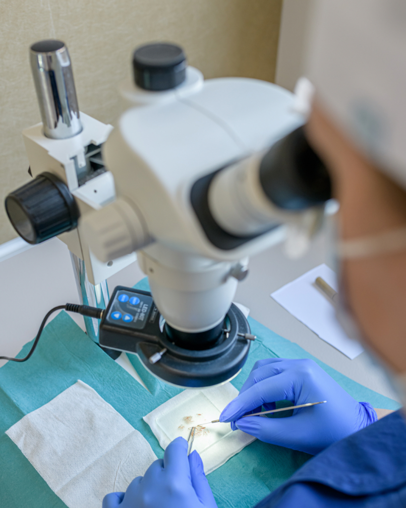 un médecin examine les greffons et les tri au microscope