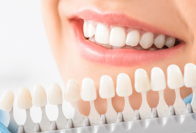 sourire d'une femme devant les teintes de dents pour couronne