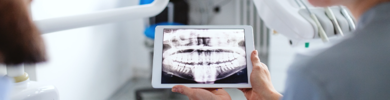 radiographie sante dentaire pour un bilan