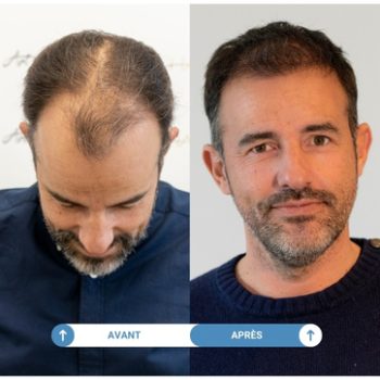 étude de cas cédric