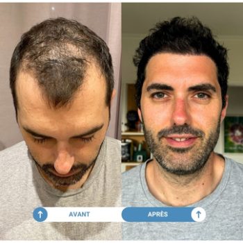 étude de cas nicolas