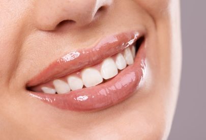 sourire parfait dents blanches et alignées