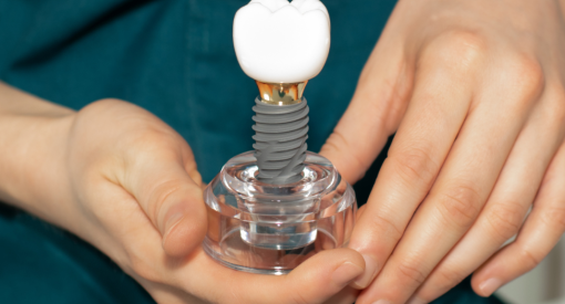 couronne sur implant dentaire
