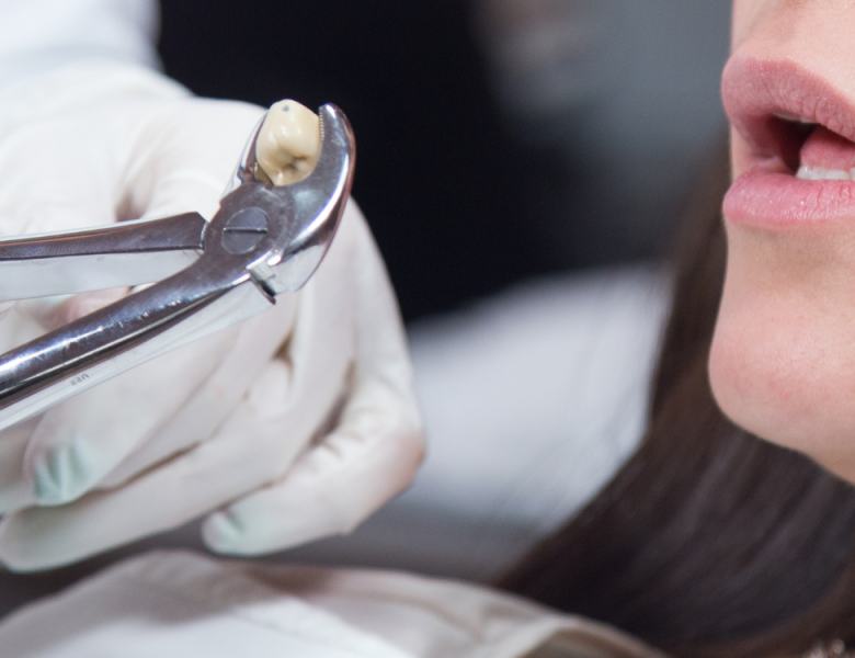 dentiste qui extrait une dent