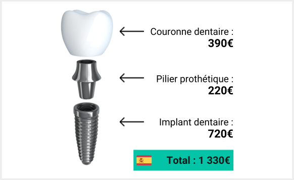 prix implant dentaire espagne