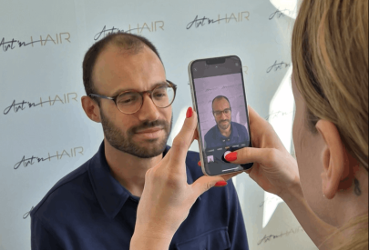 témoignage greffe de cheveux damien